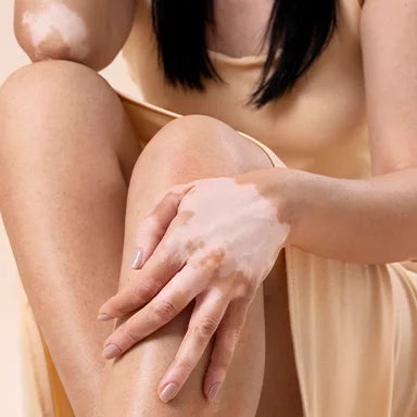 Boosting circulation & conquering cellulite - how anti-cellulite body massage oils improve blood flow
